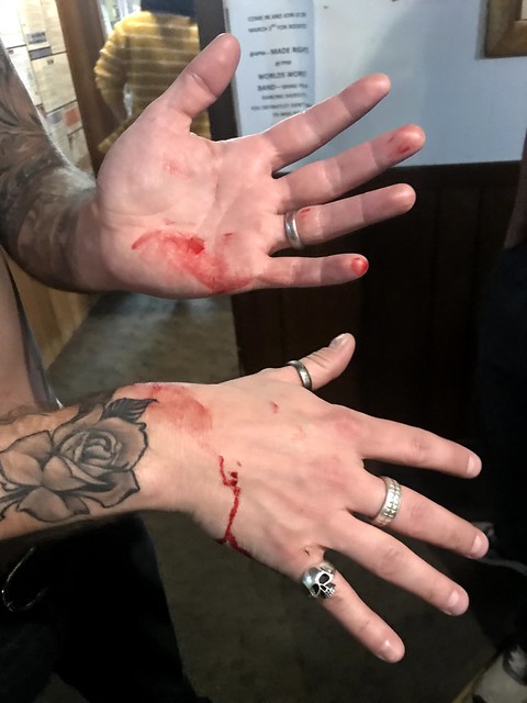 Tummy darts were a bad choice.