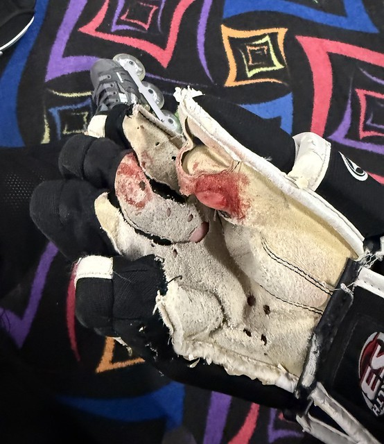 Busted my thumb up at hockey tonight. I think some new gloves are finally in order.