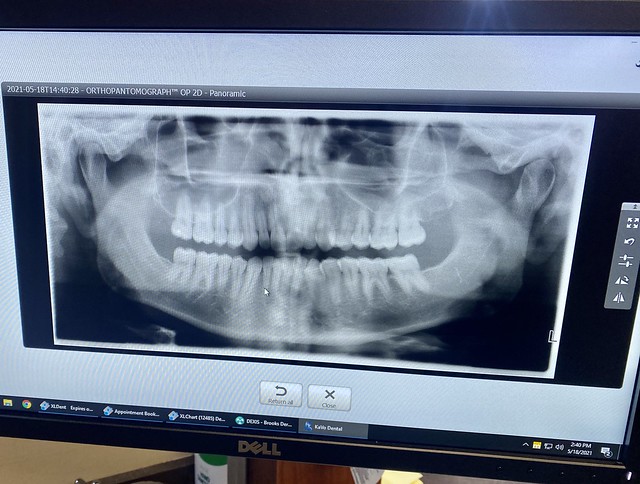 That’s my mouth and those are my teeth.