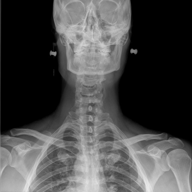 My head, neck, and some gold that I forgot to take out.