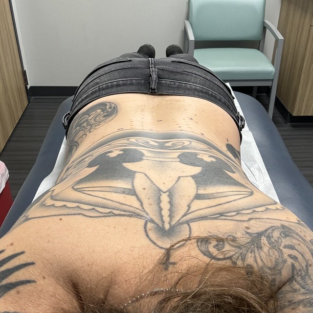 More tests to try to figure out what’s going on with my skin