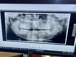 That’s my mouth and those are my teeth.