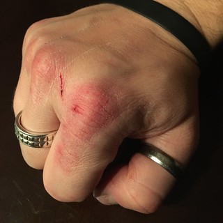 Pain - Got these construction hands