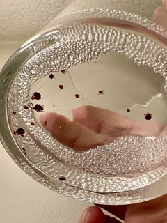 Bug - Pullin ticks off the dog