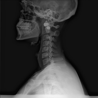 Jewelry - My head, neck, and some gold that I forgot to take out.