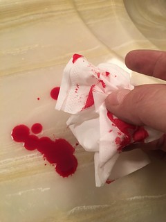Bloody finger