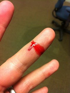 Pain - My bottle top broke off