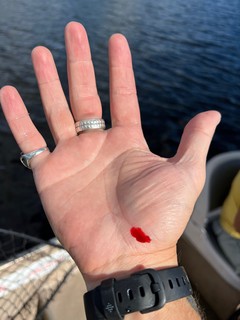 Blood - Just pulled a hook outta that palm meat. Barb and all.
