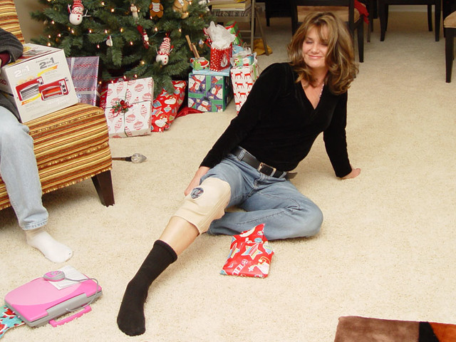 Carloyn's new knee brace