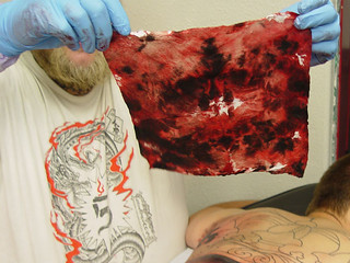 Pain - I bleed a lot