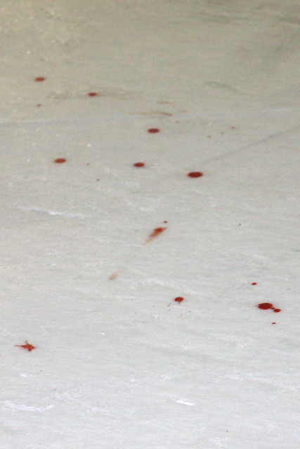 Trent's blood on the ice