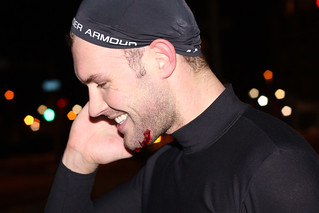 Pain - Trent's Busted Chin