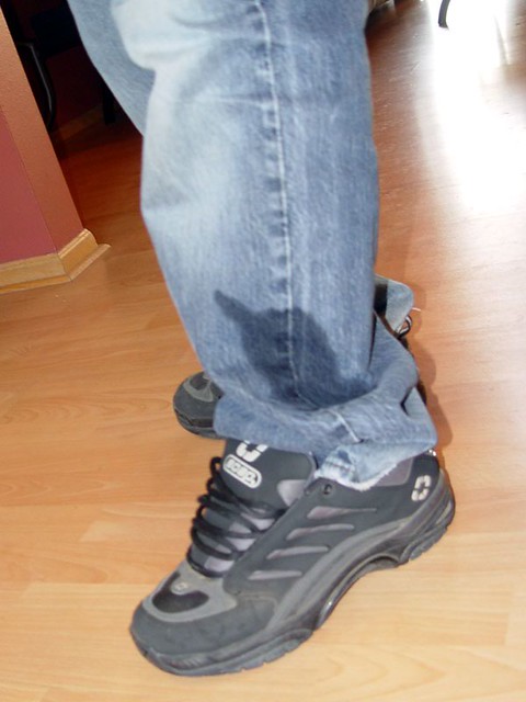 Arnold Peed on my leg