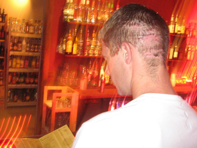 his head went through a sun roof...