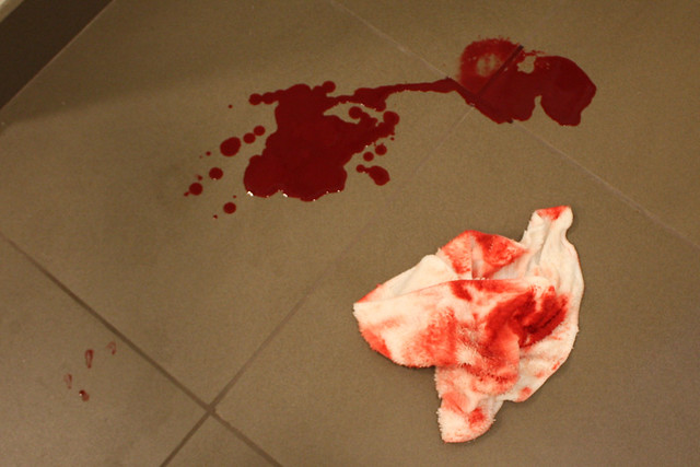 Blood from my head after fainting - that smudge is where my head was laying