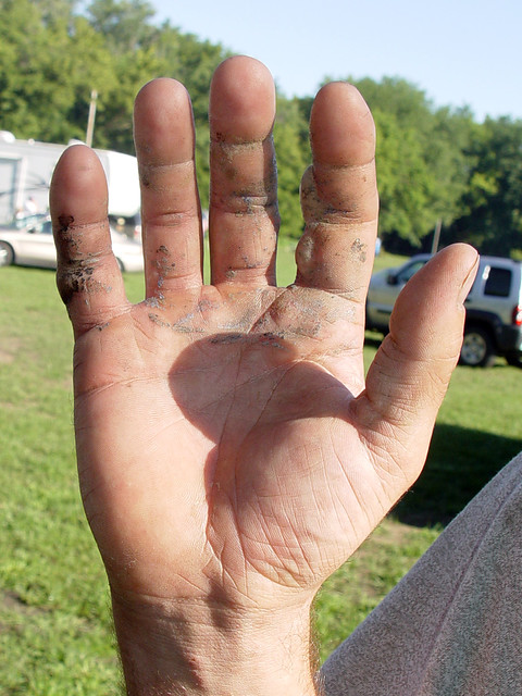 What happens when you put a plastic fire out with your hand