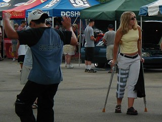 Shannon Peters - Shannon with her busted up leg