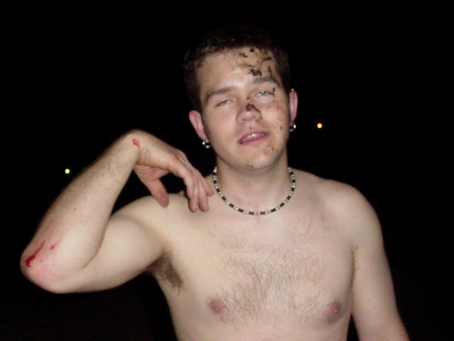 The only visible injury