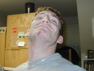 Hey Aaron, grab your chin and squeeze it as tight as you can for 1 minute! it'll turn numb, it's ...